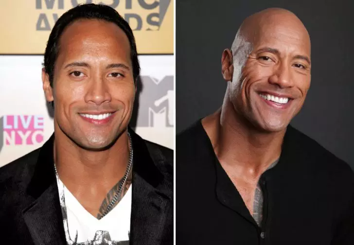 Photos of 20 Bald Celebrities When They Had Hair_10
