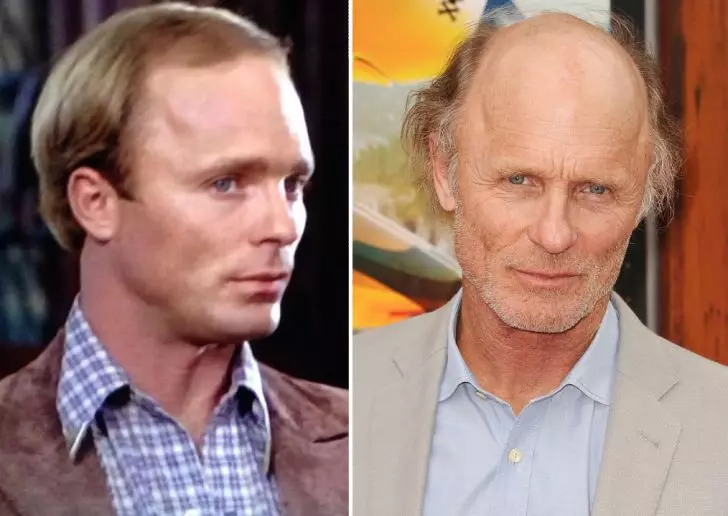 Photos of 20 Bald Celebrities When They Had Hair_16