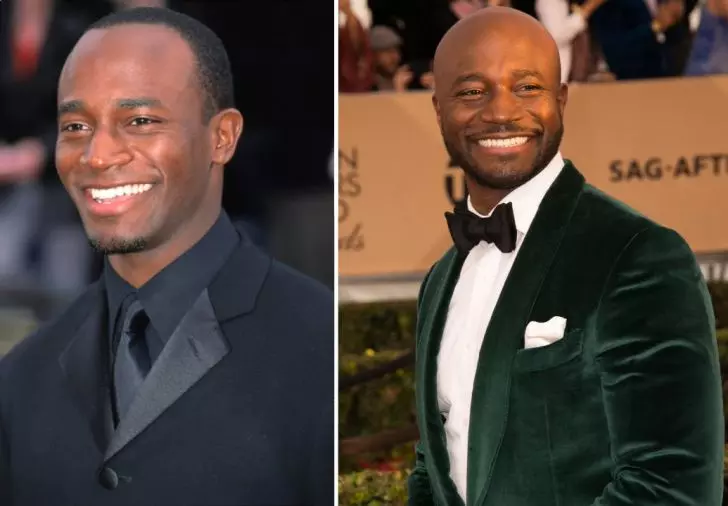 Photos of 20 Bald Celebrities When They Had Hair_17