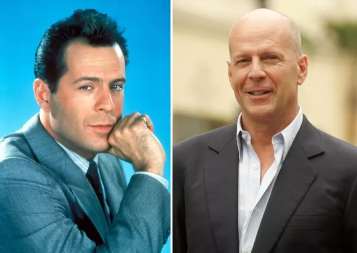 Photos of 20 Bald Celebrities When They Had Hair_7